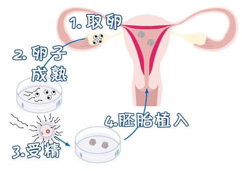供精代怀价格供卵试管婴儿中心